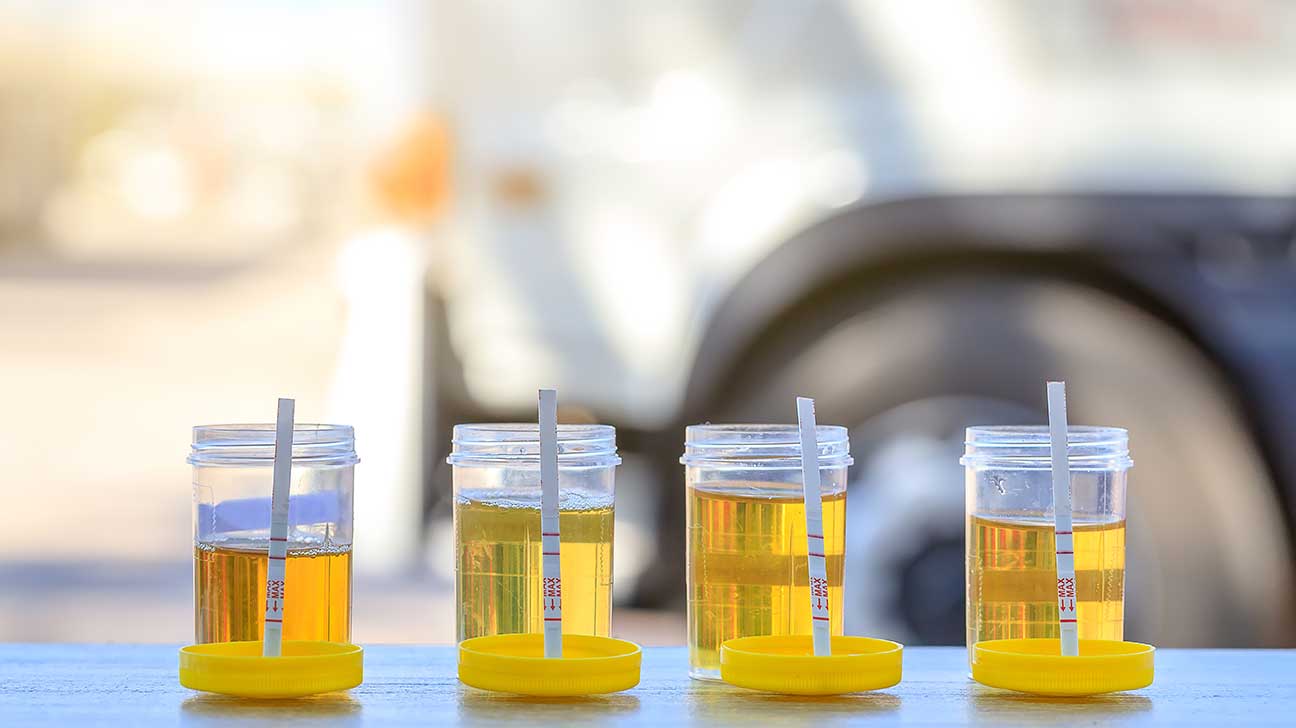 How Long Can Adderall Be Detected In Your Urine?
