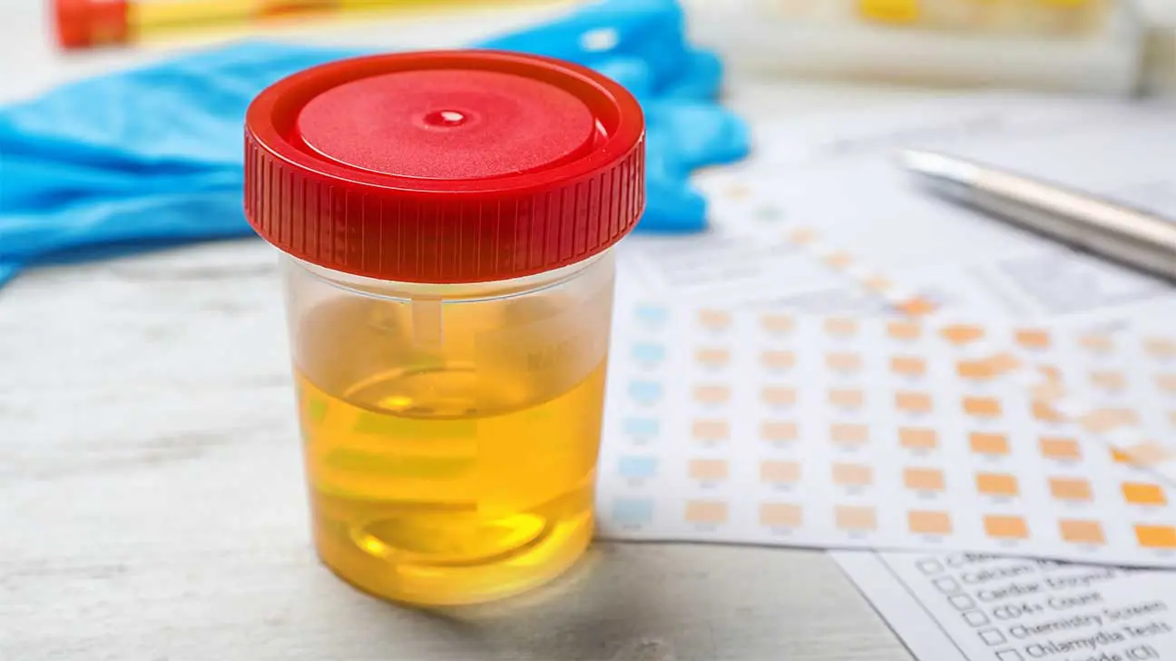 How Long Can Demerol Be Detected In Your Urine?