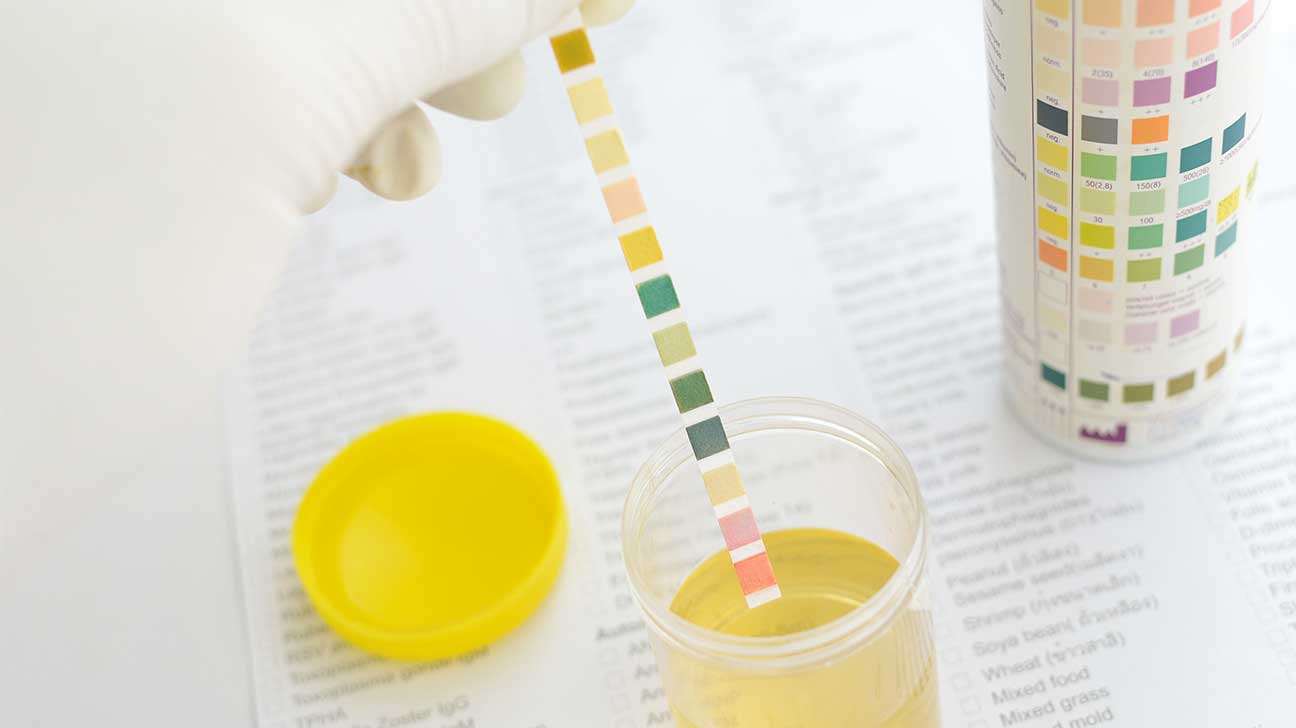 How Long Can Hydrocodone Be Detected In Your Urine?