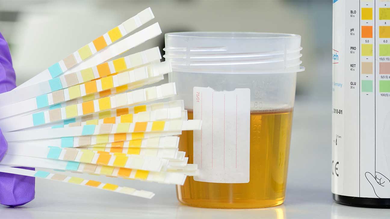 How Long Can Meth Be Detected In Your Urine?