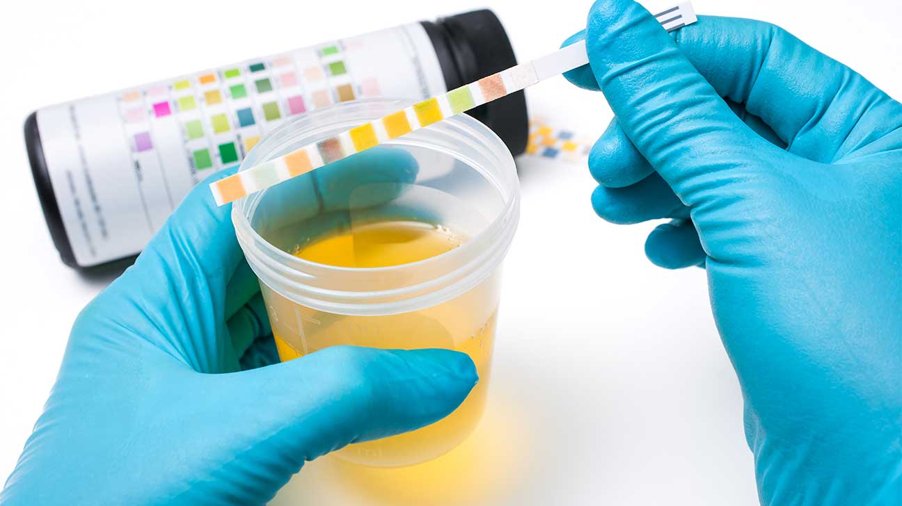 How Long Can You Detect Molly In Your Urine?