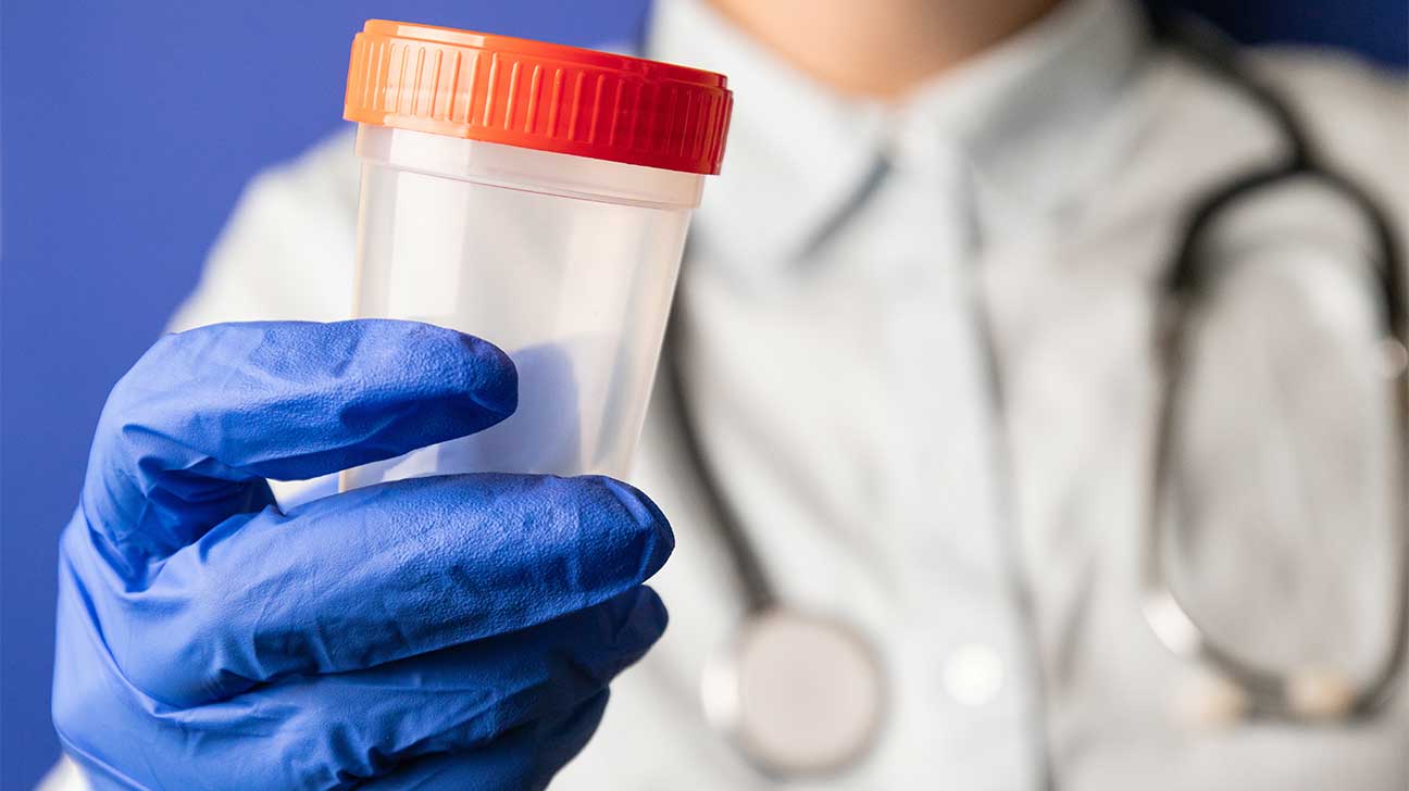 How Long Can Morphine Be Detected In Your Urine?