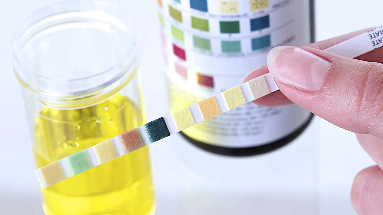 Detecting Opioids Through A Urine Test
