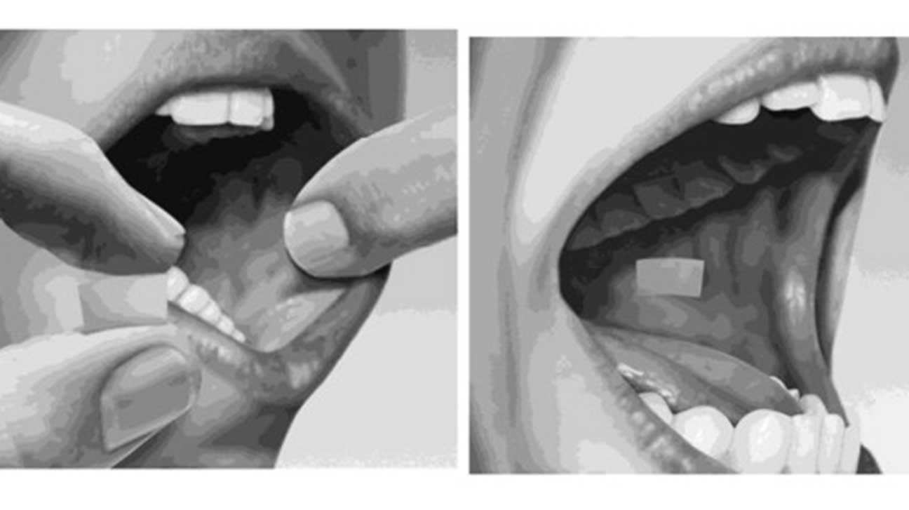 How To Use Suboxone Strips - Proper Way To Take Suboxone Film