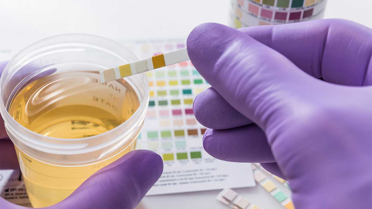 How Long Can Benzos Be Detected In Urine